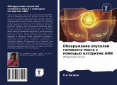 Obnaruzhenie opuholej golownogo mozga s pomosch'ü algoritma ANN