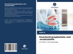 Knochentransplantate und -ersatzstoffe - S., Rohit