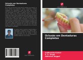 Oclusão em Dentaduras Completas