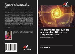 Cover Rilevamento del tumore al cervello utilizzando l'algoritmo ANN