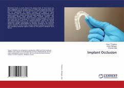 Implant Occlusion - Palathra, Vinoy T;Mahajan, Arushi;Bali, Poonam