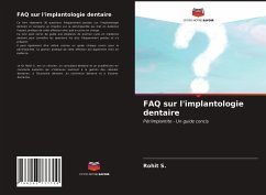 FAQ sur l'implantologie dentaire - S., Rohit