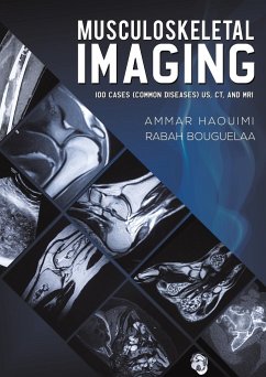 Musculoskeletal Imaging - Haouimi, Ammar; Bouguelaa, Rabah