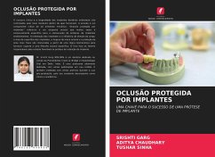 OCLUSÃO PROTEGIDA POR IMPLANTES - Garg, Srishti;Chaudhary, Aditya;Sinha, Tushar