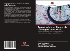 Topographie en Cancer du côlon gauche et droit - Luisetto, Mauro;Hamid, Gamal Abdul;Mashori, Ghulam Rasool
