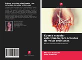 Edema macular relacionado com oclusões de veias retinianas