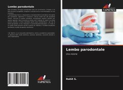 Lembo parodontale - S., Rohit