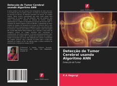 Cover Detecção de Tumor Cerebral usando Algoritmo ANN