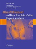 Atlas of Ultrasound- and Nerve Stimulation-Guided Regional Anesthesia (eBook, PDF)