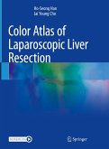 Color Atlas of Laparoscopic Liver Resection (eBook, PDF)