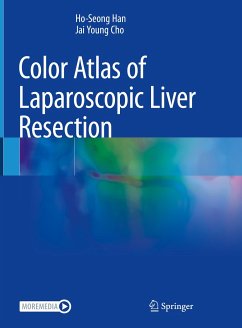 Color Atlas of Laparoscopic Liver Resection (eBook, PDF) - Han, Ho-Seong; Cho, Jai Young