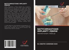 NATYCHMIASTOWE IMPLANTY Z¿BÓW - Kasi, Swathi Vardhan