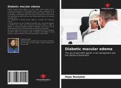 Diabetic macular edema - Boutahar, Hajar