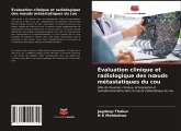 Évaluation clinique et radiologique des n¿uds métastatiques du cou