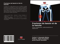 Fractures du bassin et de la hanche - Quesada Molina, Carlos F.; Tapia Fernández, Pedro J.; Bureo González, Javier