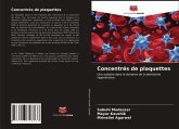 Concentrés de plaquettes