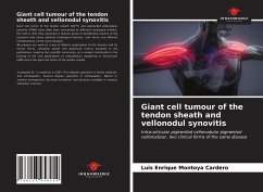 Giant cell tumour of the tendon sheath and vellonodul synovitis - Montoya Cardero, Luis Enrique