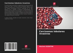 Carcinomas lobulares invasivos - KSENTINI, Meriem