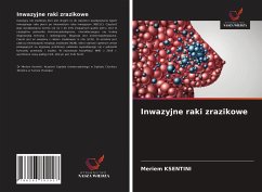 Cover Inwazyjne raki zrazikowe
