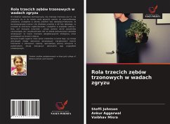 Rola trzecich z¿bów trzonowych w wadach zgryzu - Johnson, Steffi;Aggarwal, Ankur;Misra, Vaibhav