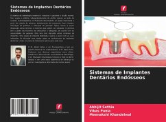 Sistemas de Implantes Dentários Endósseos - Sethia, Abhijit; Punia, Vikas; Khandelwal, Meenakshi