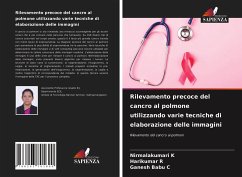 Rilevamento precoce del cancro al polmone utilizzando varie tecniche di elaborazione delle immagini - K, Nirmalakumari;R, Harikumar;C, Ganesh Babu