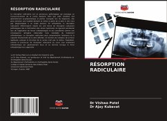 RÉSORPTION RADICULAIRE - Patel, Dr Vishwa;Kubavat, Dr Ajay