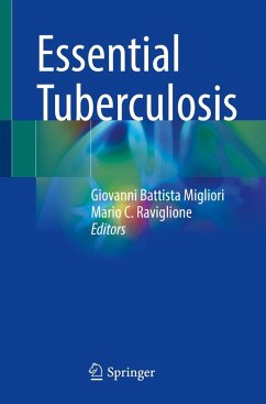 Essential Tuberculosis (eBook, PDF)