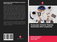 Expansão Palatal Rápida Assistida Mini-implanta - Revdekar, Anisha; Sabane, Anand; Patil, Amol