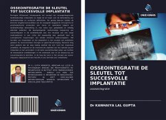 OSSEOINTEGRATIE DE SLEUTEL TOT SUCCESVOLLE IMPLANTATIE - LAL GUPTA, Dr KANHAIYA