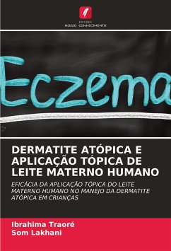 DERMATITE ATÓPICA E APLICAÇÃO TÓPICA DE LEITE MATERNO HUMANO - Traoré, Ibrahima;Lakhani, Som