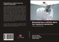 Biomatériaux utilisés dans les implants dentaires - Patel, Kavan; Duseja, Sareen; Patel, Vilas