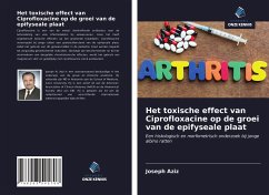 Het toxische effect van Ciprofloxacine op de groei van de epifyseale plaat - Aziz, Joseph