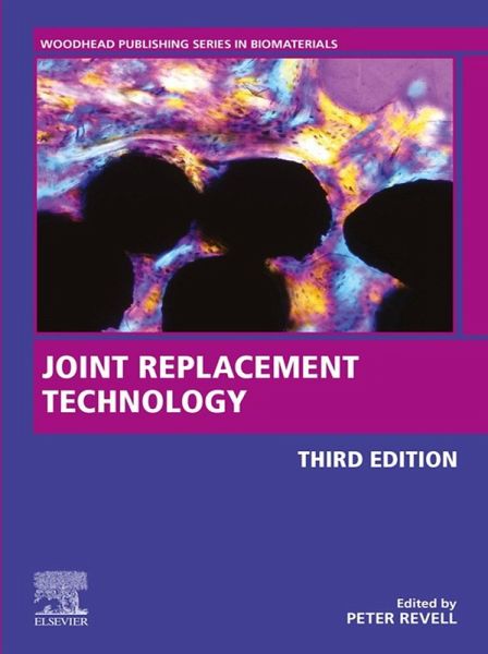 Joint Replacement Technology (eBook, ePUB) Joint Replacement Technology (eBook, ePUB)
