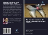 Rol van de krachten die op de endodontische stift werken