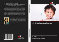 Carie della prima infanzia - Somvanshi, Priti C.; Bommangoudar, Jyothi