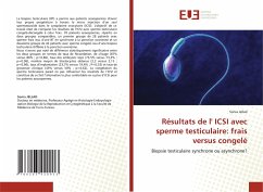 Résultats de l' ICSI avec sperme testiculaire: frais versus congelé - JELLAD, Sonia