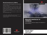 Discoid meniscus in children