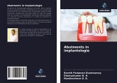 Abutments in implantologie