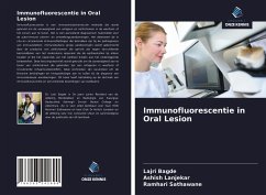 Immunofluorescentie in Oral Lesion - Bagde, Lajri; Lanjekar, Ashish; Sathawane, Ramhari