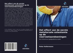 Het effect van de eerste metatarsale osteotomie op de voorvoetaandoeningen - Kellermann, Peter