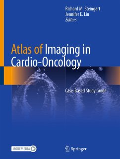 Atlas of Imaging in Cardio-Oncology (eBook, PDF)