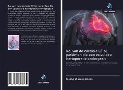 Rol van de cardiale CT bij patiënten die een valvulaire hartoperatie ondergaan - Bhutia, Kincho Lhasong