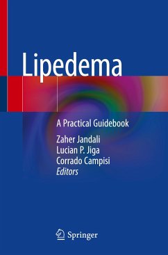 Lipedema