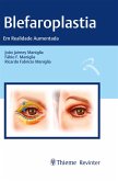 Blefaroplastia (eBook, ePUB)