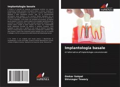 Implantologia basale - Sakpal, Omkar;Tewary, Shivsagar