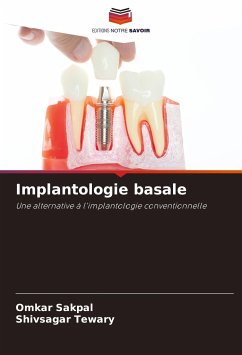 Implantologie basale - Sakpal, Omkar;Tewary, Shivsagar