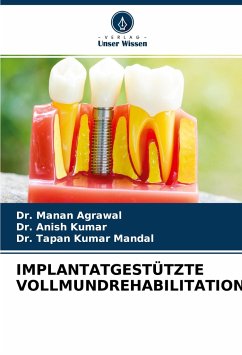 IMPLANTATGESTÜTZTE VOLLMUNDREHABILITATION - Agrawal, Dr. Manan;Kumar, Dr. Anish;Mandal, Dr. Tapan Kumar