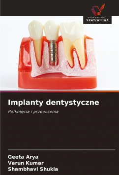 Implanty dentystyczne - Arya, Geeta;Kumar, Varun;Shukla, Shambhavi