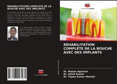 RÉHABILITATION COMPLÈTE DE LA BOUCHE AVEC DES IMPLANTS - Agrawal, Dr. Manan;Kumar, Dr. Anish;Mandal, Dr. Tapan Kumar